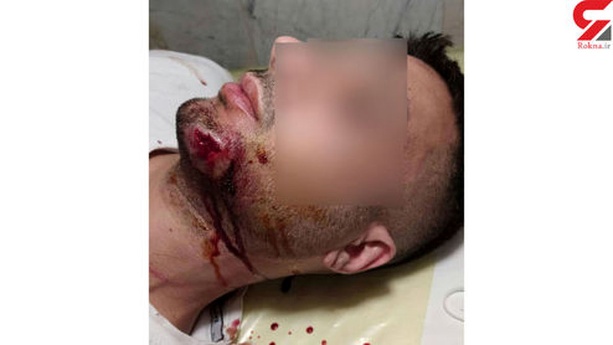 کتک بدی که جوان آبادانی مقابل همسرش خورد +عکس