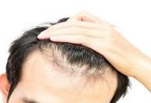 چطور از چرب شدن مو‌ها جلوگیری کنیم؟