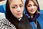 چهره جدید نیوشا ضیغمی بعد از عمل بینی +عکس