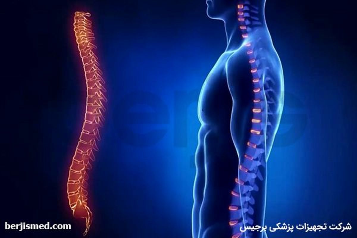 لوردوز (Lordosis) چیست و چگونه درمان می‌شود؟