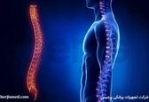 لوردوز (Lordosis) چیست و چگونه درمان می‌شود؟