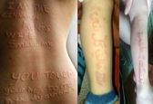 بیماری عجیب پوستی به نام معجزه! +عکس 