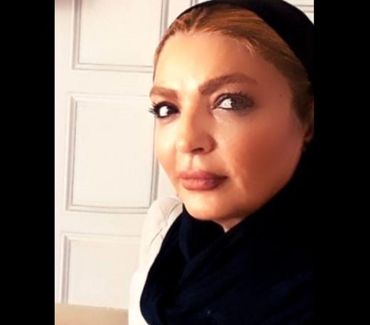 تغییر چهره شهرزاد عبدالمجید+عکس