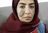 گریم عجیب ساناز سماواتی  در فیلم جدیدش+ عکس 