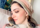 دماغ کوفته و عقابی بهنوش طباطبایی قبل عمل زیبایی