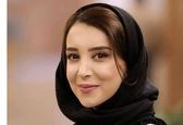 این خانم بازیگر با عمل زیبایی فکش فلج شد / سحر جعفری کیست ؟