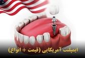 ایمپلنت دندان در آمریکا (مقایسه قیمت به دلار و تومان)
