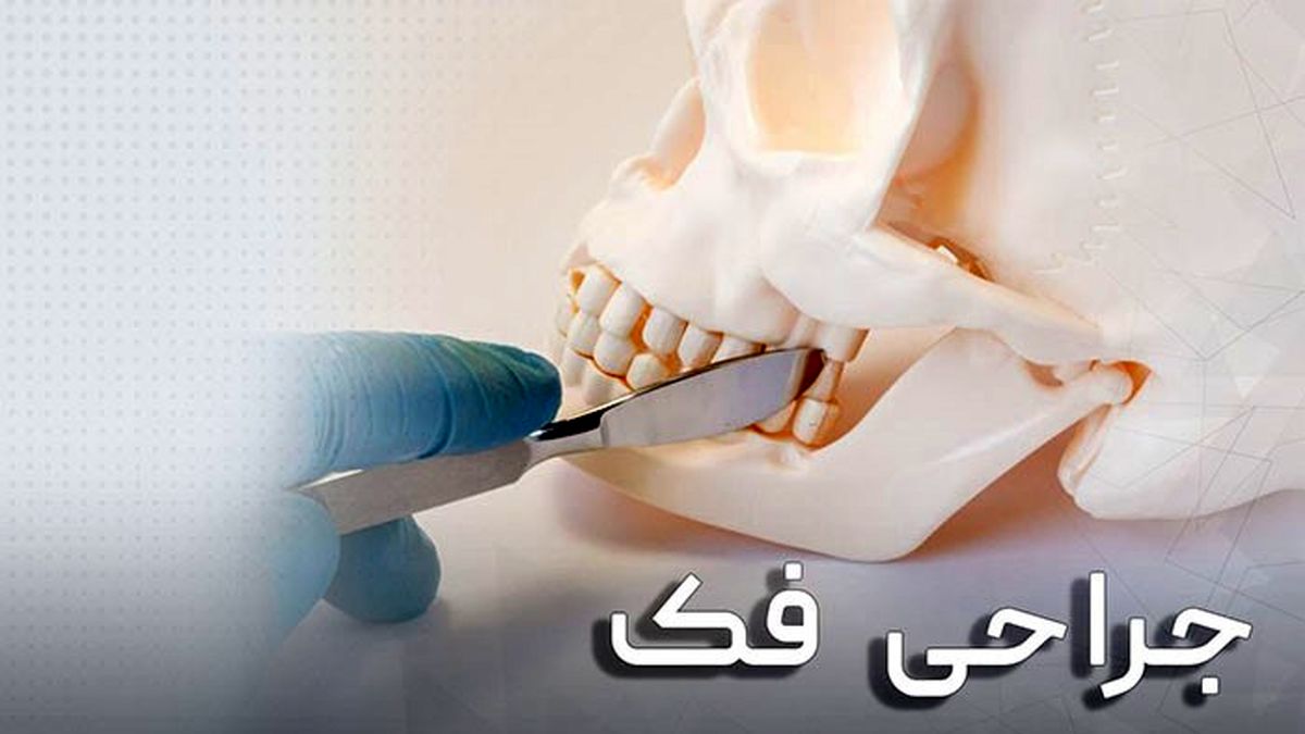 انواع جراحی فک و صورت