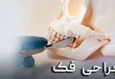 انواع جراحی فک و صورت