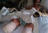 بلای وحشتناکی که سگ خانگی بر سر صاحبش آورد!+عکس