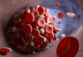 کرونا چطور باعث سکته قلبی و مغزی می‌شود؟