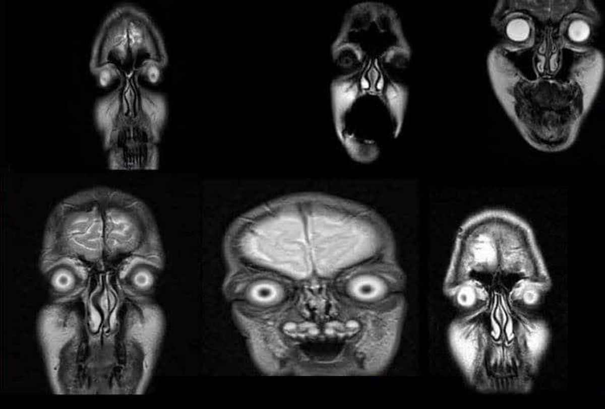 تصاویر ترسناک از MRI صورت انسان