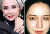 خوشگل‌تر شدن شبنم قلی خانی بعد از عمل زیبایی+ عکس 