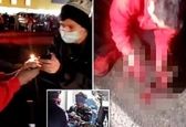 انفجار ترقه در دست دو جوان ۱۸ و ۱۹ ساله +عکس