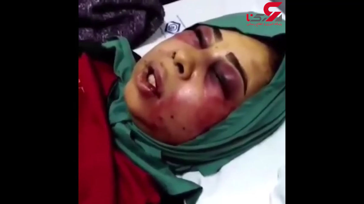 شکنجه دردناک زن زرندی توسط شوهرش+عکس