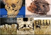 بازار داغ پزشکی زیبایی در مصر باستان ! +عکس