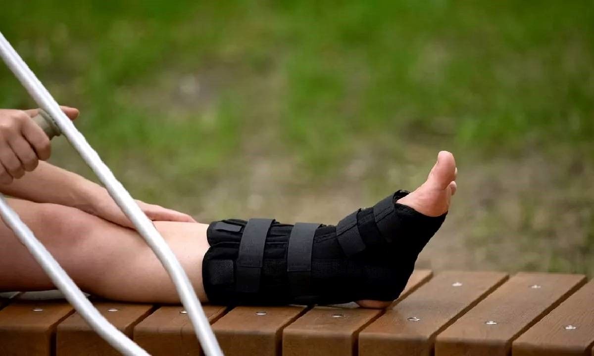 شکستگی مچ پا: انواع شکستگی، تشخیص، جلوگیری آن چگونه است؟