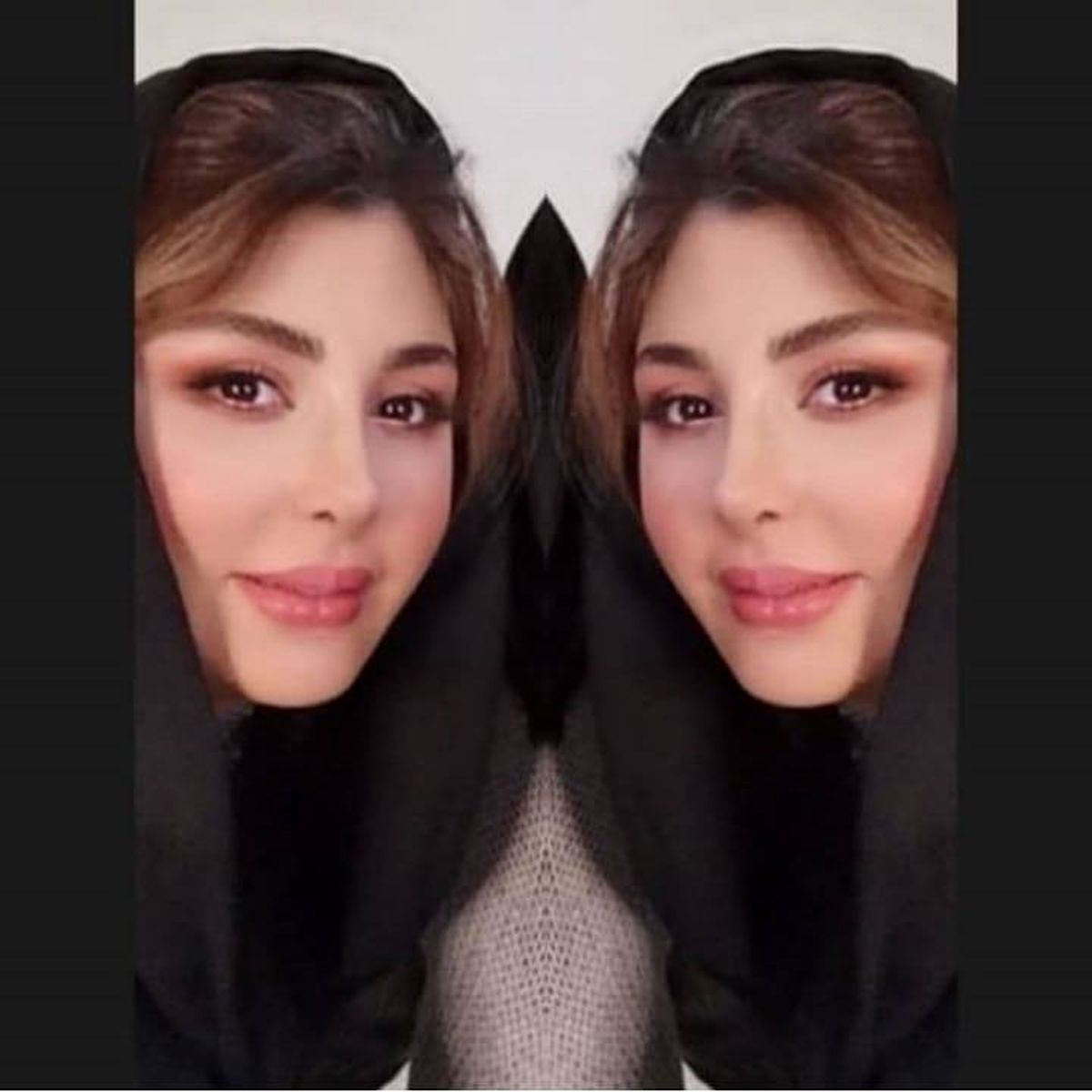 سلفی نیوشا ضیغمی با مدل جدید بینی اش! +عکس