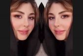 مدل جدید بینی نیوشا ضیغمی پس از جراحی! +عکس