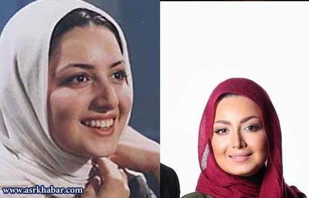 تغییر چهره خارق العاده شیلا خداداد بعداز عمل زیبایی+عکس