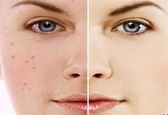 چگونه از طریق رنگ پوست می‌توان به نوع بیماری پی برد؟
