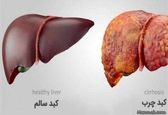 خارشی که نشانه بیماری کبدی است