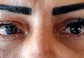 زنی که بخاطر زیبایی خود را نابینا کرد +عکس