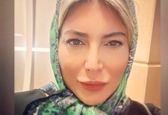 چهره فیلر دار فریبا نادری با این نما 