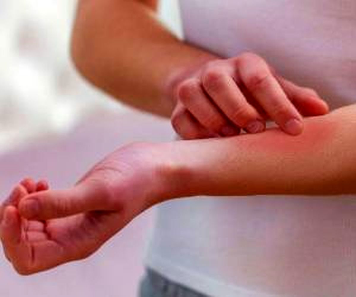 چرا حشرات نیش می زنند و خون میخورند؟