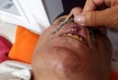 ضرب و شتم یک جانباز توسط شکارچیان +عکس