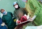 خروج توده ۵ کیلویی از شکم خانم ۴۲ ساله +عکس 