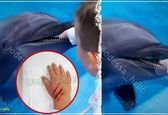 حمله غافلگیرانه دلفین به کودک +عکس