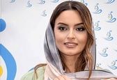 عکس قبل و بعد نیولفر پارسا ! / چهره باورنکردنی 