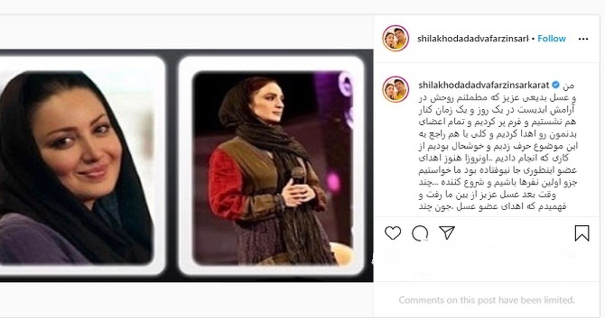 ماجرای اهدای عضو شیلا خداداد و عسل بدیعی +عکس 