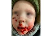 حمله وحشتناک سگ وحشی به یک کودک + فیلم 