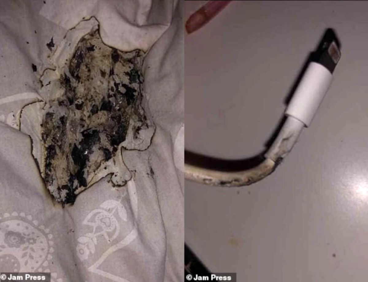 انفجار شارژر آیفون،صورت دختر جوان را سوزاند! +عکس