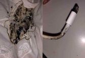 انفجار شارژر آیفون،صورت دختر جوان را سوزاند! +عکس