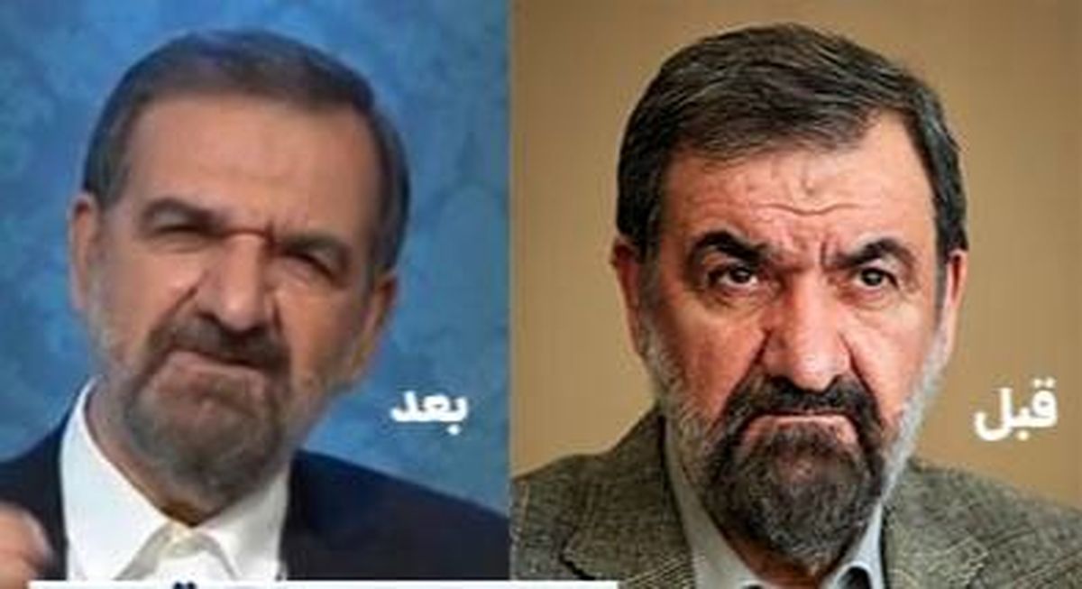 علت تغییر چهره محسن رضایی چیست؟+عکس