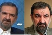 علت تغییر چهره محسن رضایی چیست؟+عکس