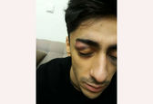 ضرب و شتم ملی‌پوش ژیمناستیک توسط افراد ناشناس +عکس 