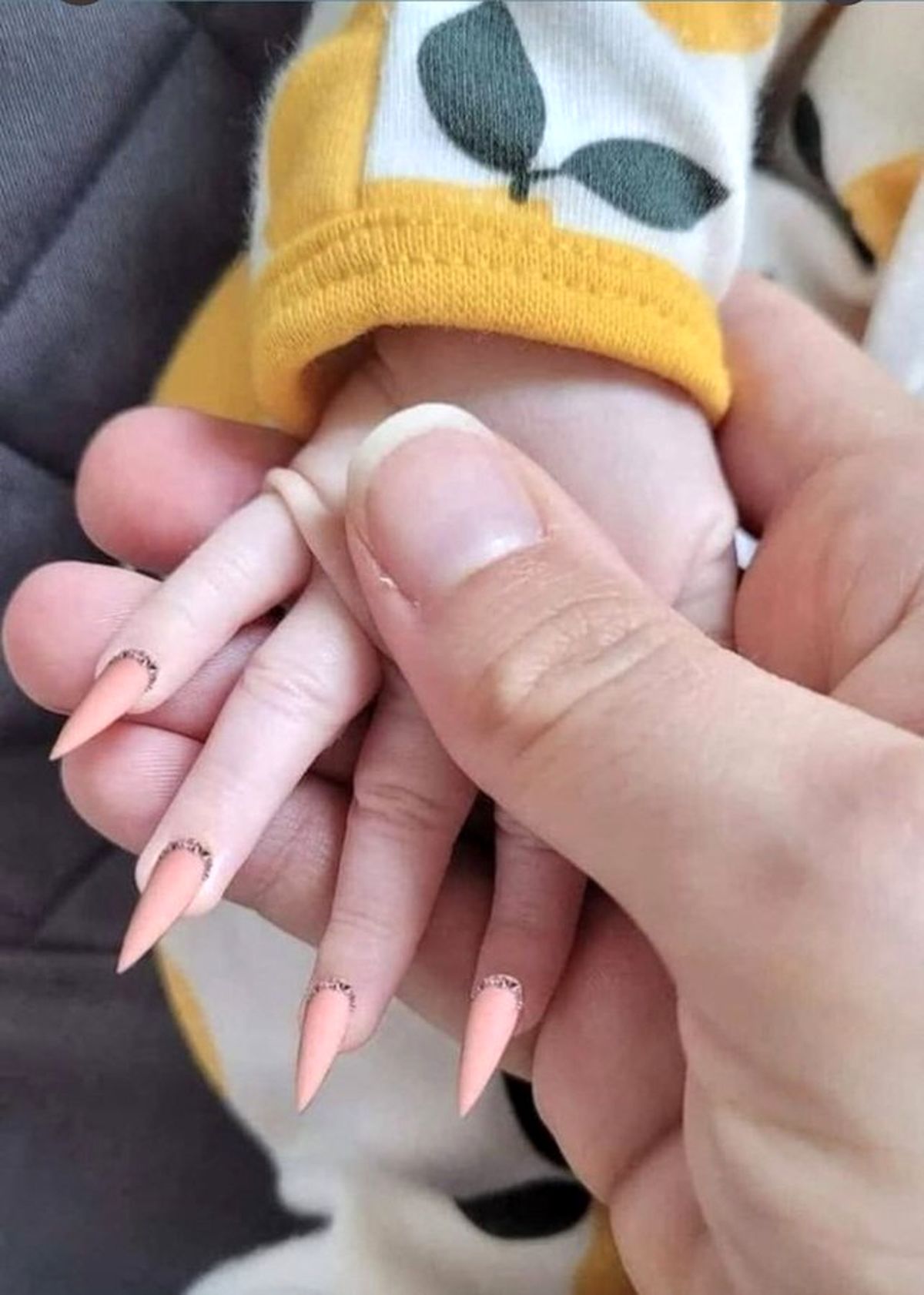 تصویر دلخراش از کاشت ناخن برای نوزاد +عکس