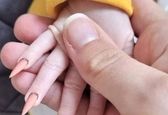 تصویر دلخراش از کاشت ناخن برای نوزاد +عکس