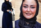 قیافه وحشتناک شقایق فراهانی بعد عمل زیبایی +عکس
