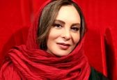 چهره داغون افسانه بایگان بعد از عمل زیبایی / عکس جنجالی