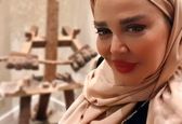 پوست ناجور بهاره رهنما با این نما | بهاره رهنما پیر شد !