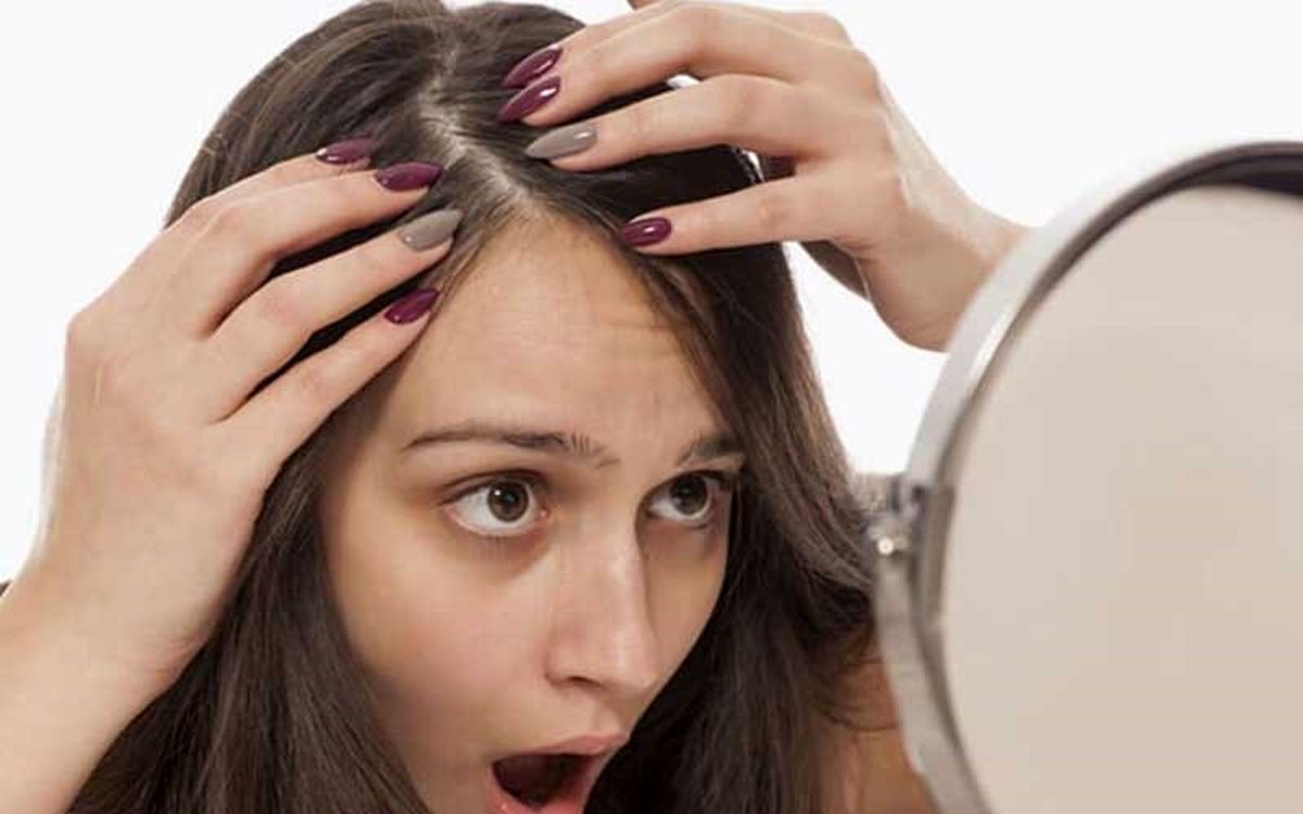 قویترین داروی رشد مجدد مو چیست؟