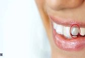 آیا به تازگی متوجه تغییر رنگ در دندان‌هایتان شده‌اید؟
