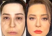 مهراوه شریفی نیا قبل و بعد از خودکشی! +عکس