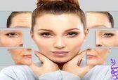 4 روش پرطرفدار برای لیفت صورت بدون جراحی