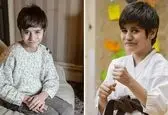 سندرم عجیبی که فقط یک نفر به آن مبتلاست! +عکس 